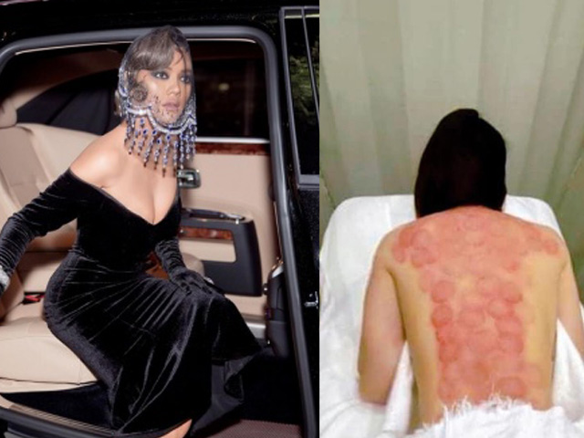 Nữ 'đại gia ngầm' có vòng 1 sexy nhất V-biz tung ảnh lưng trần nhưng ai nấy đều lo lắng