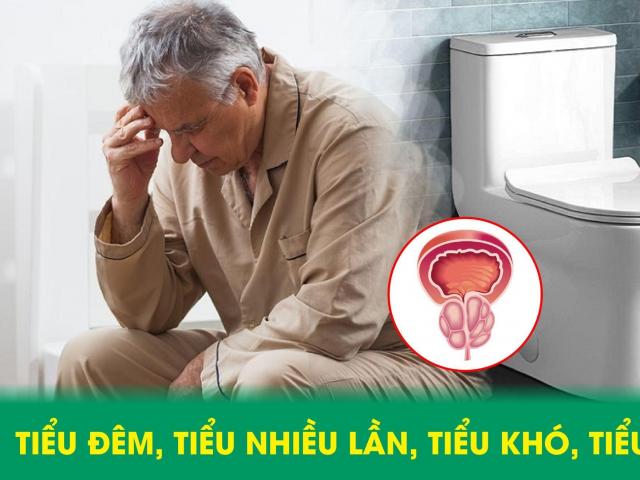 Tiểu đêm, tiểu nhiều lần, tiểu khó ở nam giới – lời “cảnh báo” từ tuyến tiền liệt ở nam giới