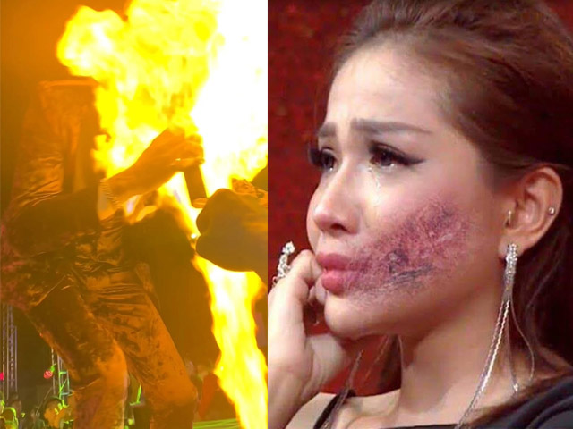 Nữ DJ Đà thành hốt hoảng khi bị lửa táp thẳng mặt, CEO Hậu Giang bỏng nặng cấp 2