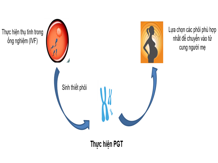 Sàng lọc di truyền trước chuyển phôi PGT MAX 1 - Giải pháp sinh con khỏe mạnh