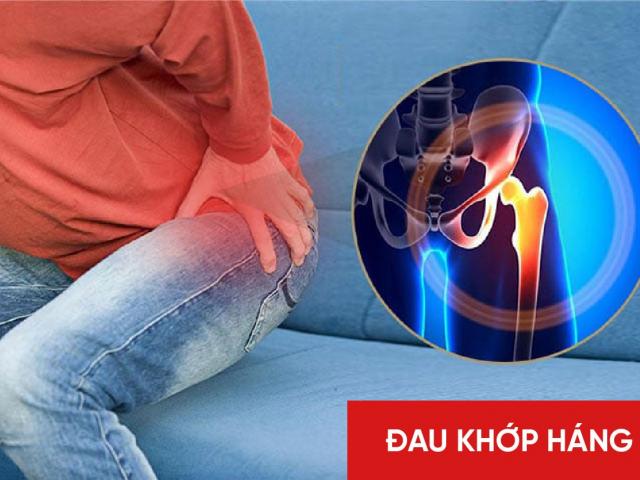 Đau khớp háng bên phải, trái và cách xử lý hiệu quả tư vấn bởi chuyên gia